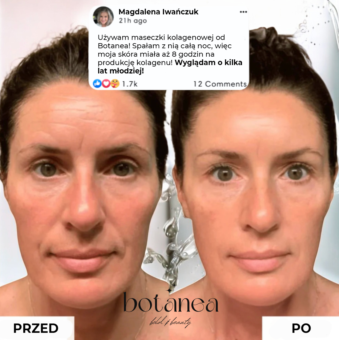 Kolagenowa Maseczka z Kwasem Kojowym Botanea™