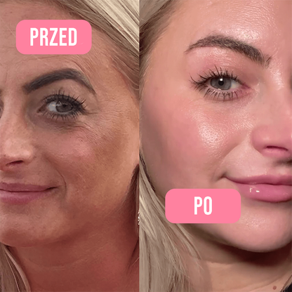 Kolagenowy Żel-Krem z Niacynamidem