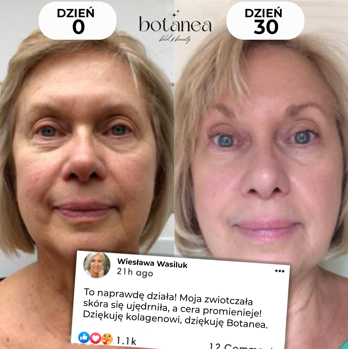 Kolagenowa Maseczka z Kwasem Kojowym Botanea™