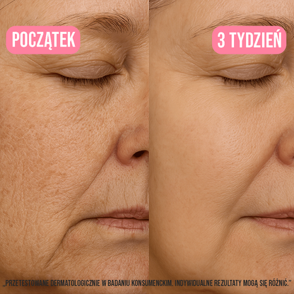 Kolagenowy Żel-Krem z Niacynamidem