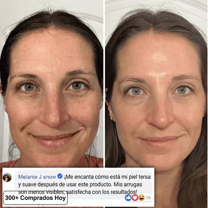 Botanea PDRN Pink Collagen Multi Balm